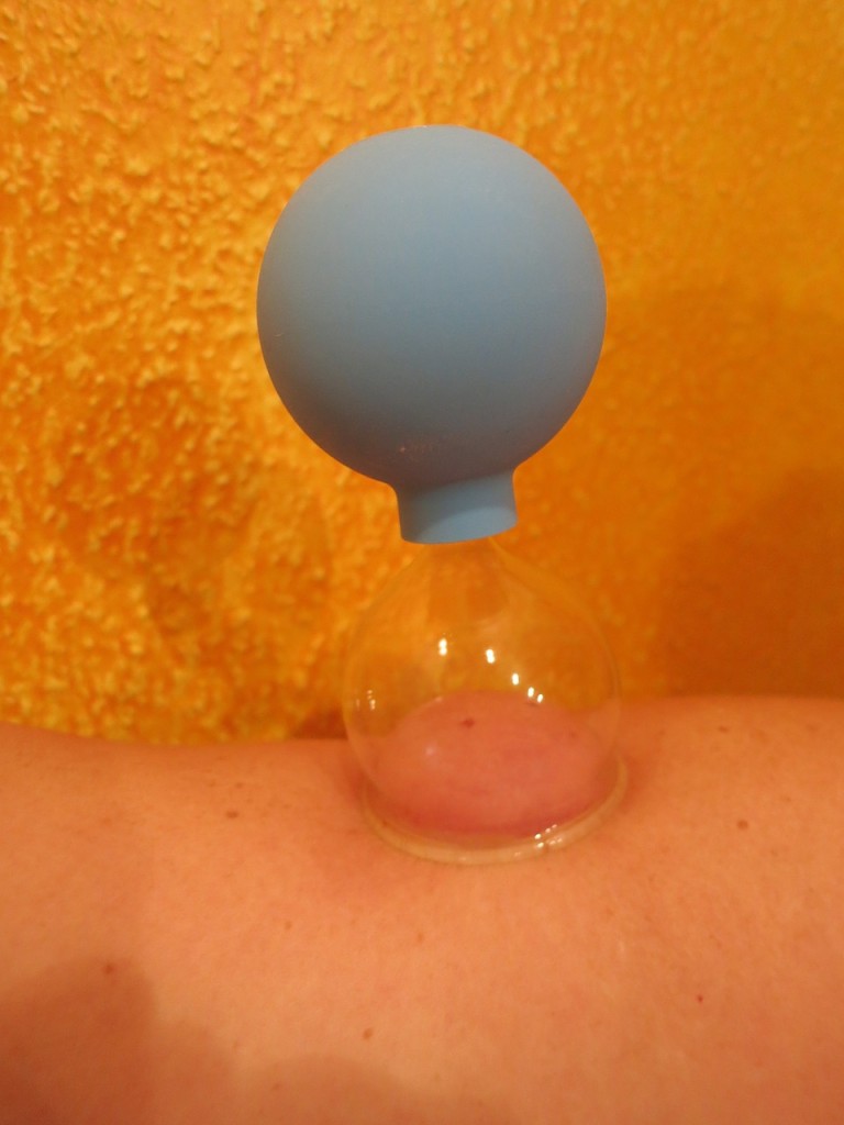 On a testé pour vous : le Massage Cupping™